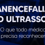 Anencefalia Diagnóstico Precoce, Diferenciais e Como Comunicar com Segurança - IAC - Instituto Arruda Camara