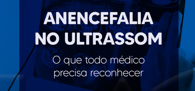 Anencefalia Diagnóstico Precoce, Diferenciais e Como Comunicar com Segurança - IAC - Instituto Arruda Camara