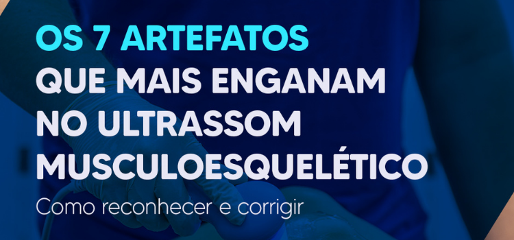 Guia de Bolso Artefatos que Mais Enganam no Musculoesquelético - Como Reconhecer e Corrigir (2026) - Instituto Arruda Camara - IAC