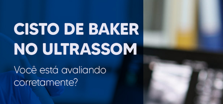 Ultrassom do Joelho Cisto de Baker, Diagnósticos Diferenciais e Avaliação Posterior Completa (Guia 2026) - Instituto Arruda Camara - IAC