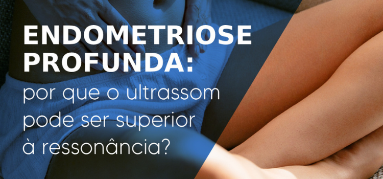 Endometriose Profunda_ Onde o Ultrassom Supera Outros Métodos - 20-04-2026 - Instituto Arruda Camara - IAC
