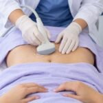 Pós-Graduação em Ultrassom em Ginecologia - Instituto Arruda Câmara