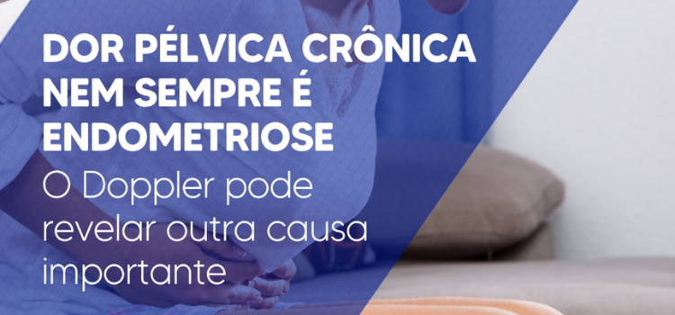 Varizes Pélvicas - Diagnóstico por Ultrassom, Doppler e Importância Clínica na Síndrome da Congestão Pélvica - Instituto Arruda Camara - IAC
