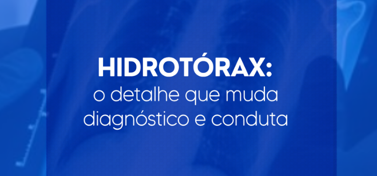 Hidrotorax no Ultrassom - O detalhe que mudou o Diagnóstico e Conduta - Instituto Arruda Camara - IAC